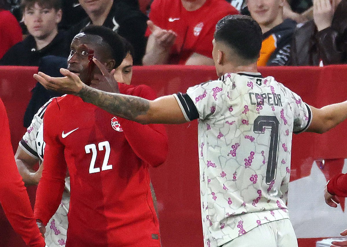 SteveRussell's tweet photo. Team Canada outlasted Chile in an international friendly at BMO Field in Toronto.
#CanadaSoccer #FIFA #TeamCanada #FutbolChile #Chile https://t.co/zJYBvw1Kgs