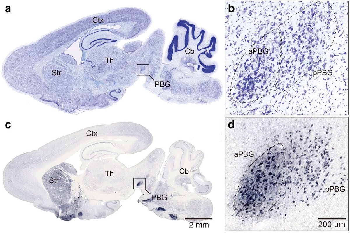 BrianRoemmele's tweet photo. A BREAKTHROUGH!

Attention isn’t new. It’s ancient.
A handful of brainstem neurons older than the dinosaurs decide what you notice. Silence them and even a faint distraction wins. Turn them back on and the noise vanishes.

This circuit exists in fish, birds, and mice. It may be the most important target we’ve ever found for ADHD.

Read more below: