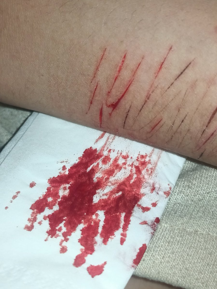 Gasleakrotazcl's tweet photo. SFX MAKEUP, NOT REAL!!!
. 
. 
. 
. https://t.co/6morAJV8Or