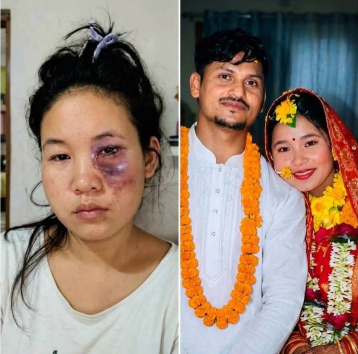 HinduNation__'s tweet photo. This is the fate that awaits all secularists—some sooner, some later—but getting cut down is inevitable for everyone.

Assam: A tribal Garo woman in Karbi

Anglong was allegedly assaulted after refusing to convert to Islam following her marriage, according to reports.

#assam

#explore

#explorepage

#islam

#love🪤