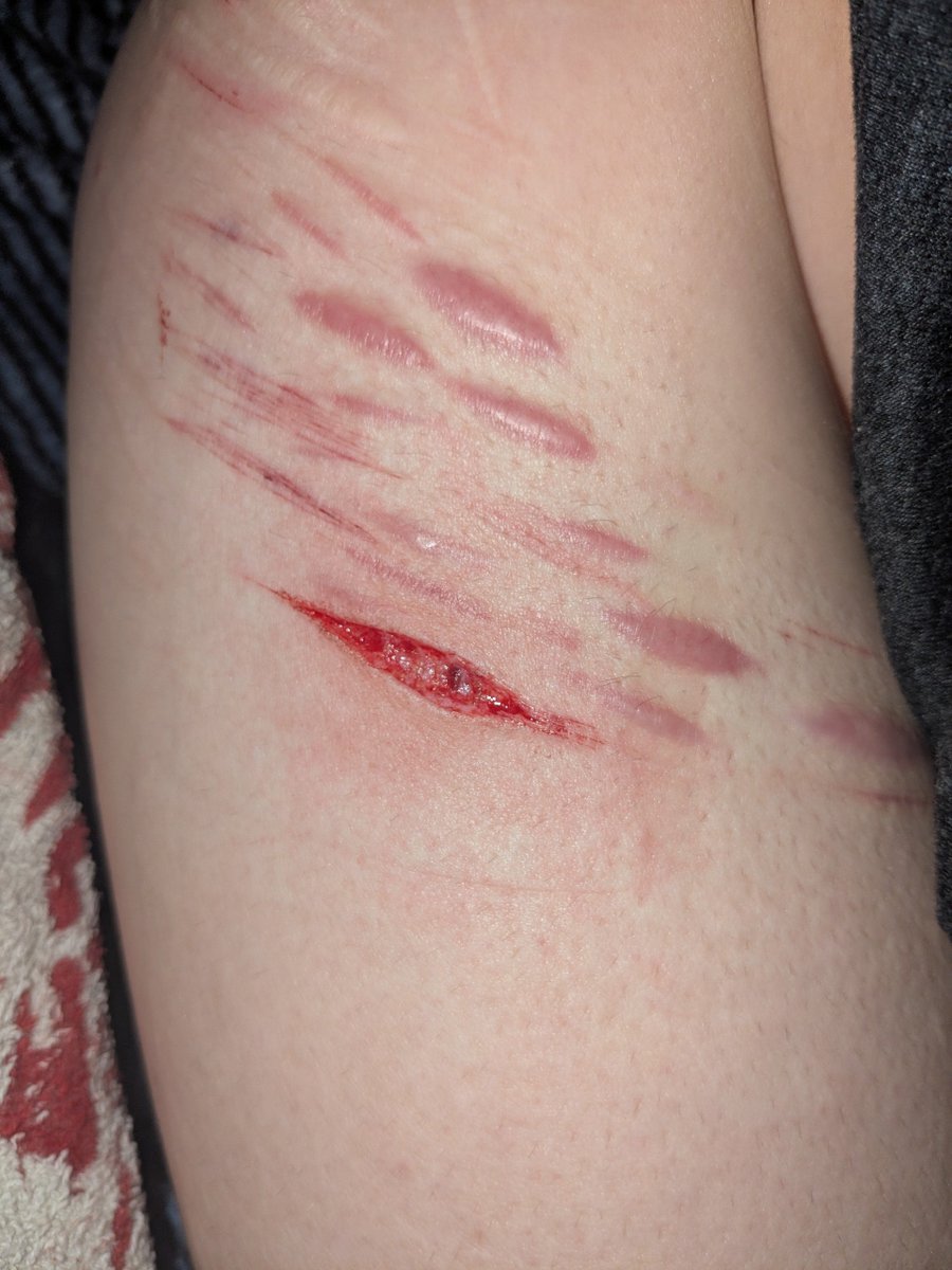 thisismejibray's tweet photo. vein? SFX FAKE AI GENERATED GROK AI MAKEUP 

#sledtwt #slittwt #shedrtwt https://t.co/vbdUHX1Dhe