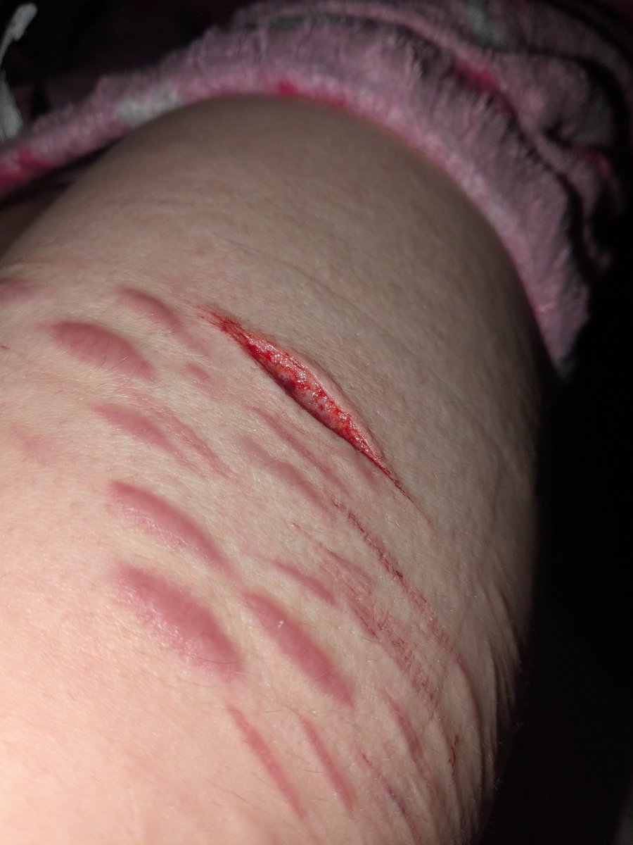 thisismejibray's tweet photo. vein? SFX FAKE AI GENERATED GROK AI MAKEUP 

#sledtwt #slittwt #shedrtwt https://t.co/vbdUHX1Dhe