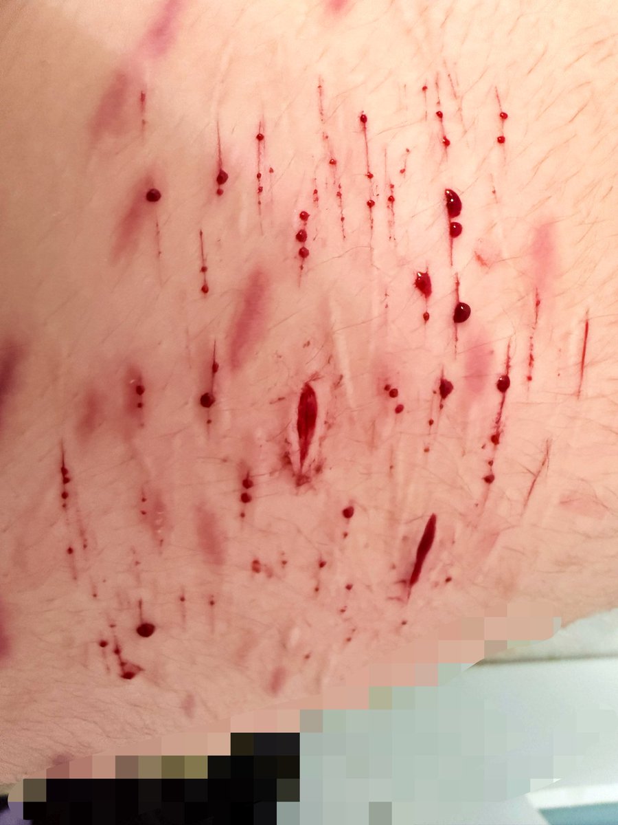 Rwnpws's tweet photo. New ai image, tbh haven’t done for awhile so I couldn’t go to deep cause of my pain tolerance lowering again #redinktwt #slittwt https://t.co/gaKCdD5CzX
