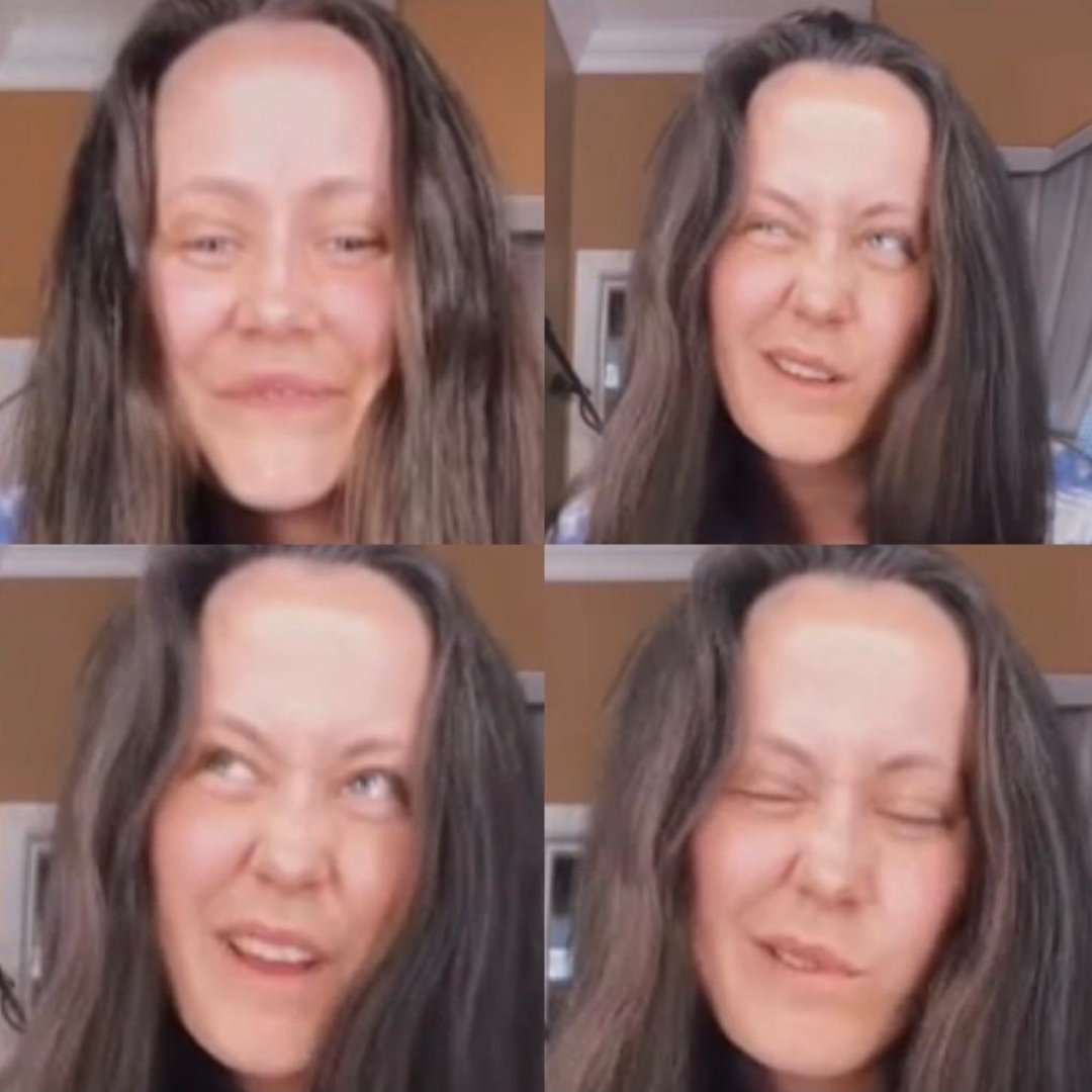 maryjanechic's tweet photo. @PBandJenelley_1 Bro your hairline is running away from you. You should out a wig on to cover that traction alopecia you got going on. Your hairline is on top of your head, Megamind. https://t.co/oYLOPrPnT0