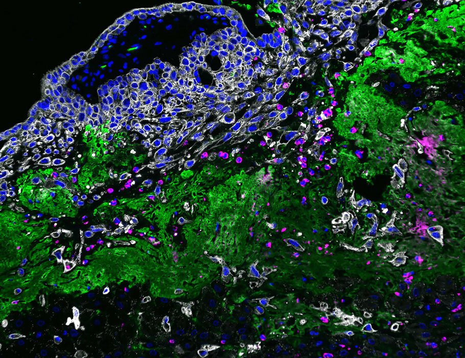 LabWaggoner's tweet photo. Neutrophils adopt a tissue-adapted state at the early maternal-fetal interface that supports trophoblast invasion
https://t.co/hOCHtFCXeq @SciImmunology @AnnaLeukin10 https://t.co/wtVt9w7d3E