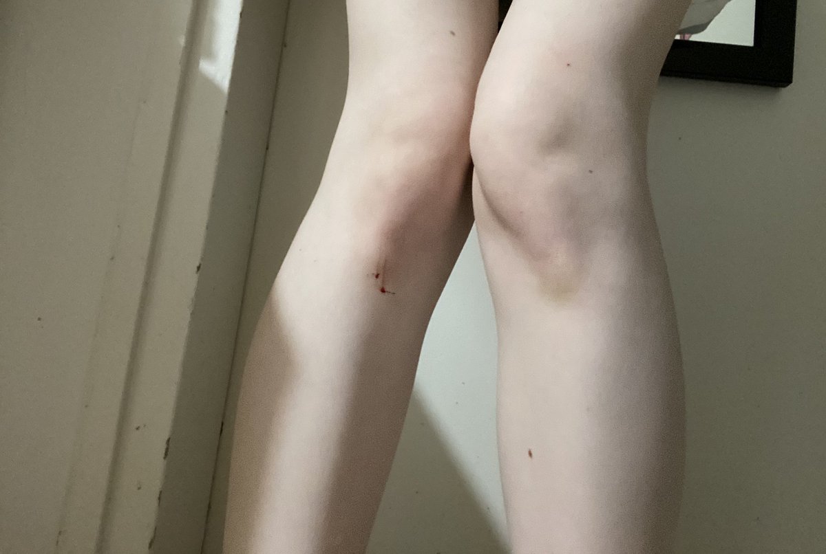 wooffwaffen's tweet photo. wonky knees https://t.co/g36bixh1IN