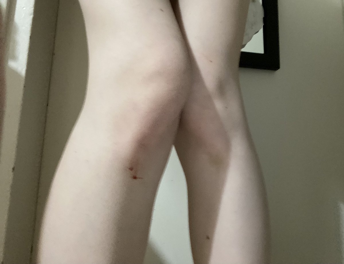 wooffwaffen's tweet photo. wonky knees https://t.co/g36bixh1IN