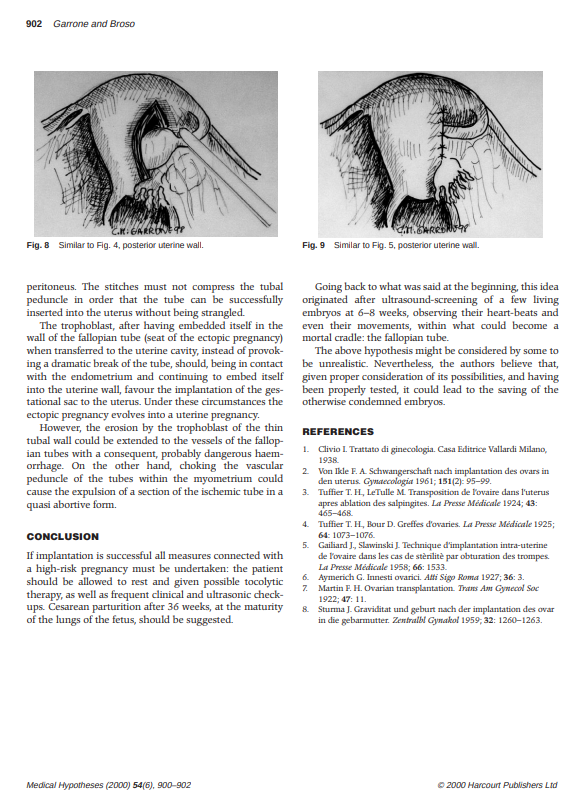 MarkProffitt's tweet photo. Example of how to innovate. Desire: save life of mother & baby. Breakdown task to satisfy each result. Use known resources. Basic surgery, uterus, developed vascularization. By the way, this has been done successfully. #medical #pregnancy #ectopic #abortion #innovation https://t.co/fHak3rLdgO