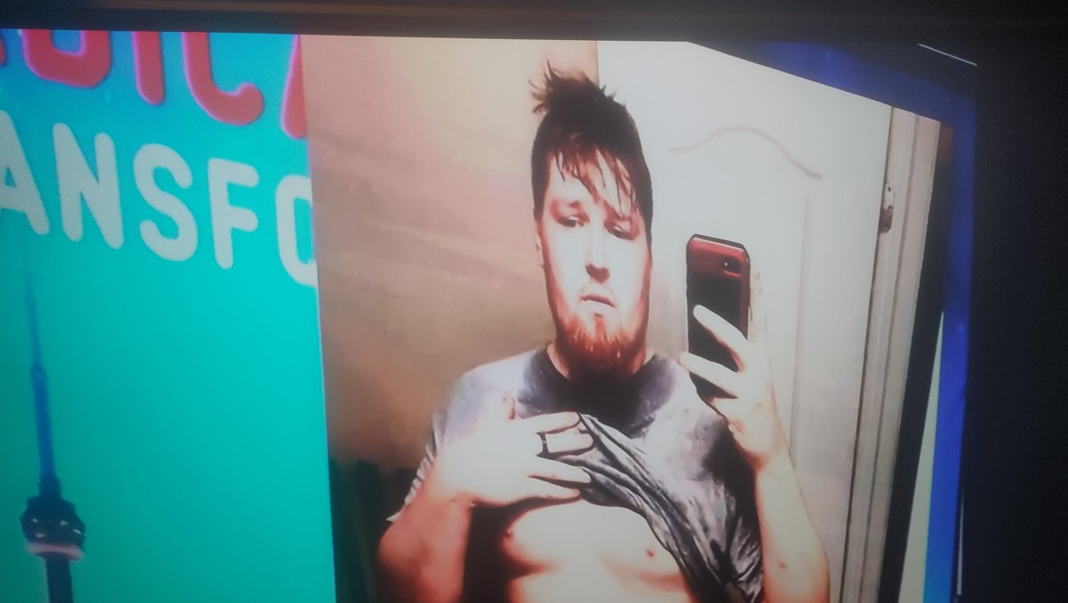 unoenessunoe's tweet photo. Il paradosso americano, una cultura basata sui cibi processati che rendono le persone obese. Allo stesso tempo l'ossessione per il corpo: ecco il fiorire dei #farmaci per dimagrire che colpiscono gli #ormoni , perché se sei grasso sei uno scarto #presadiretta https://t.co/gztAznuL4y