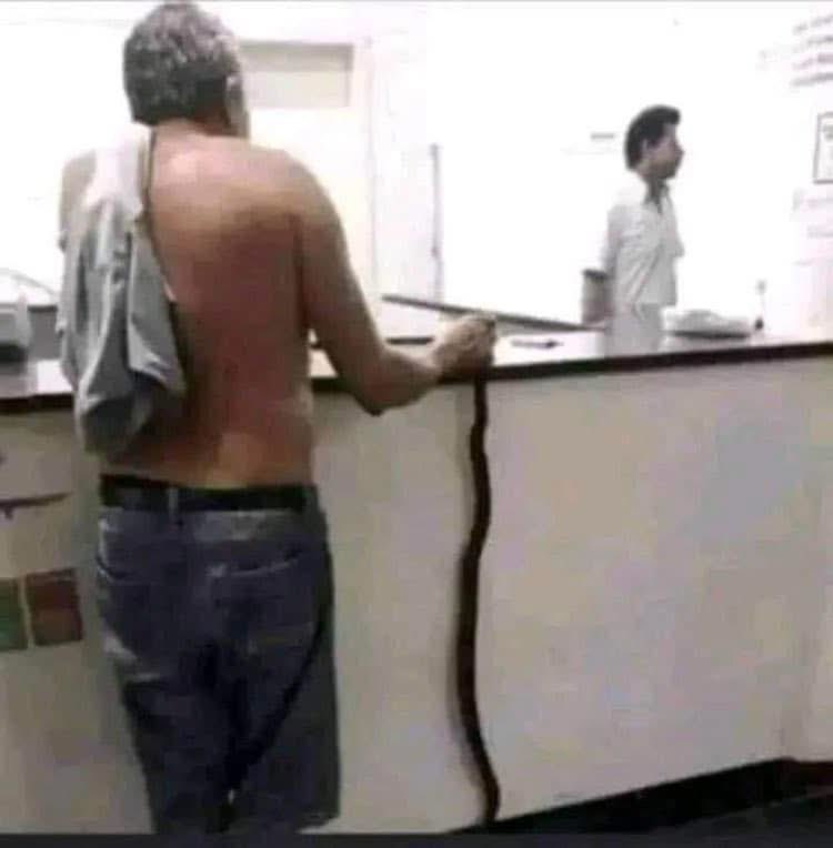 mm_mahdi26's tweet photo. فاصل مضحك 

هذا الشخص مزارع من شبوه باليمن لدغة ثعبان 🐍 ومسك الثعبان وراح به إلى المستشفى . وعند وصوله قال له الدكتور 🩺 وليش جبته معك قال عشان ماتجلس تقول لي مانوعه؟؟!!  وكيف هو؟!!!  وايش لونه؟!!!  وكم طوله؟!!!  وايش لابس ؟!!!  ومن ابوه؟!!!  وايش من قبيله ؟!!! وهل هو مع الشرعيه ولا مع الانتقالي ولا مع الحوثي؟!!!  هيا خارجني دق لي الابرة حق مصل السم💉 قبل  ما احذفه عليك  😂😂
منقول