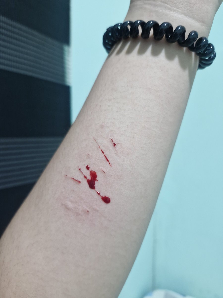 riyunnieee's tweet photo. First time cutting and second time cutting :›

#slittwt #shtwt #shhtwt https://t.co/Jjrfca8ZYR