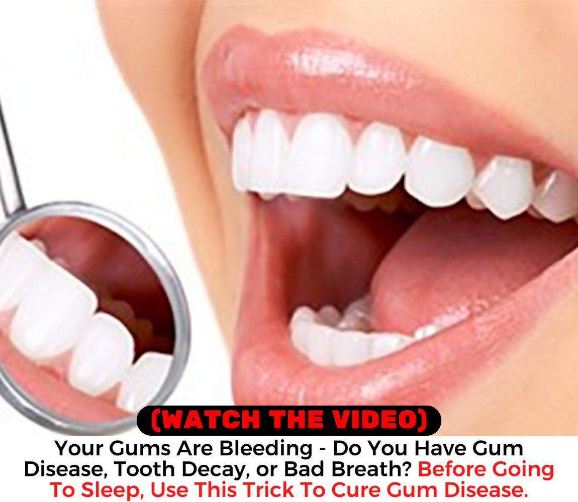 WinJose8's tweet photo. #dental #dentalcare #teethgoals #prodentimprobiotic
#teeth #smiles #prodentim #whiteteeth #healthcare
#OralCare #tooth #decay #viral #DentalHealth
Improve your overall dental well-being
with our advanced oral care solution.
👉 https://t.co/Ks5ZV3i3yO 👈 https://t.co/xKaU9b1PXy