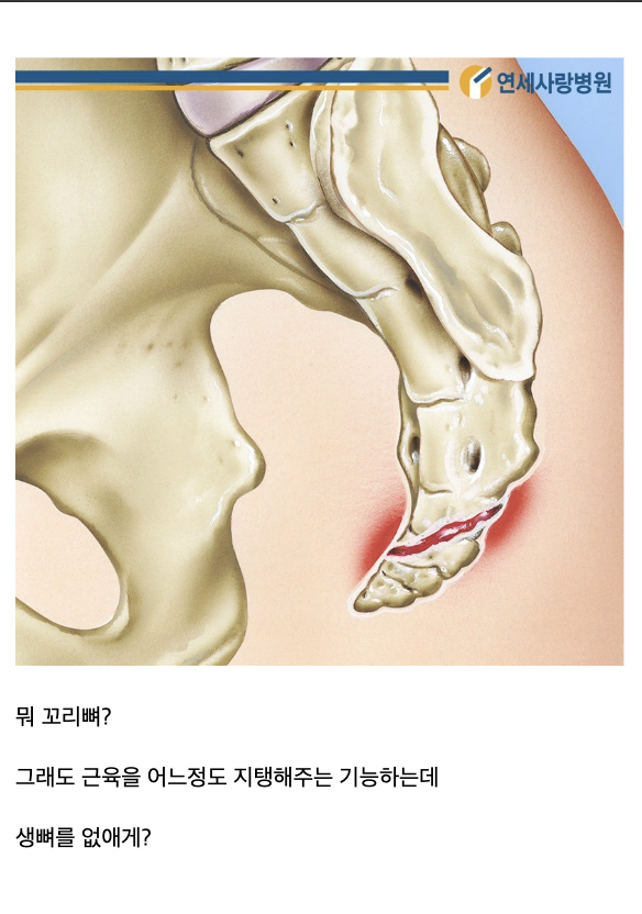 laterinfo_'s tweet photo. 이 정신나간놈 좀만 피곤하면 지맘대로 부어서 물도 못넘기게함 https://t.co/n5IuWhdyIg