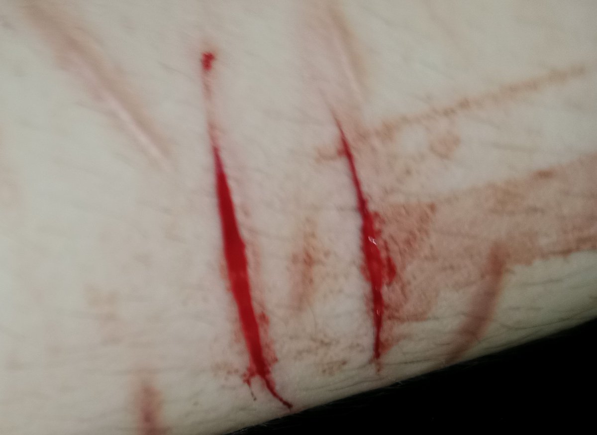 melankoliii___'s tweet photo. My meds are not taking away the emptiness 

#988twt #slittwt #selfharm
(FAKE Make up practices with red ink and AI assistance, getting ready for halloween) https://t.co/5dhrJjawWY