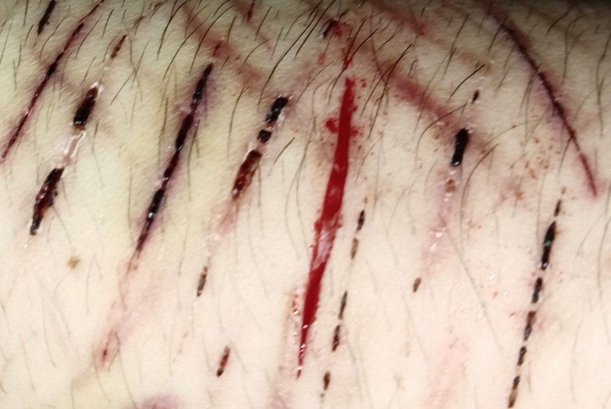 melankoliii___'s tweet photo. My meds are not taking away the emptiness 

#988twt #slittwt #selfharm
(FAKE Make up practices with red ink and AI assistance, getting ready for halloween) https://t.co/5dhrJjawWY