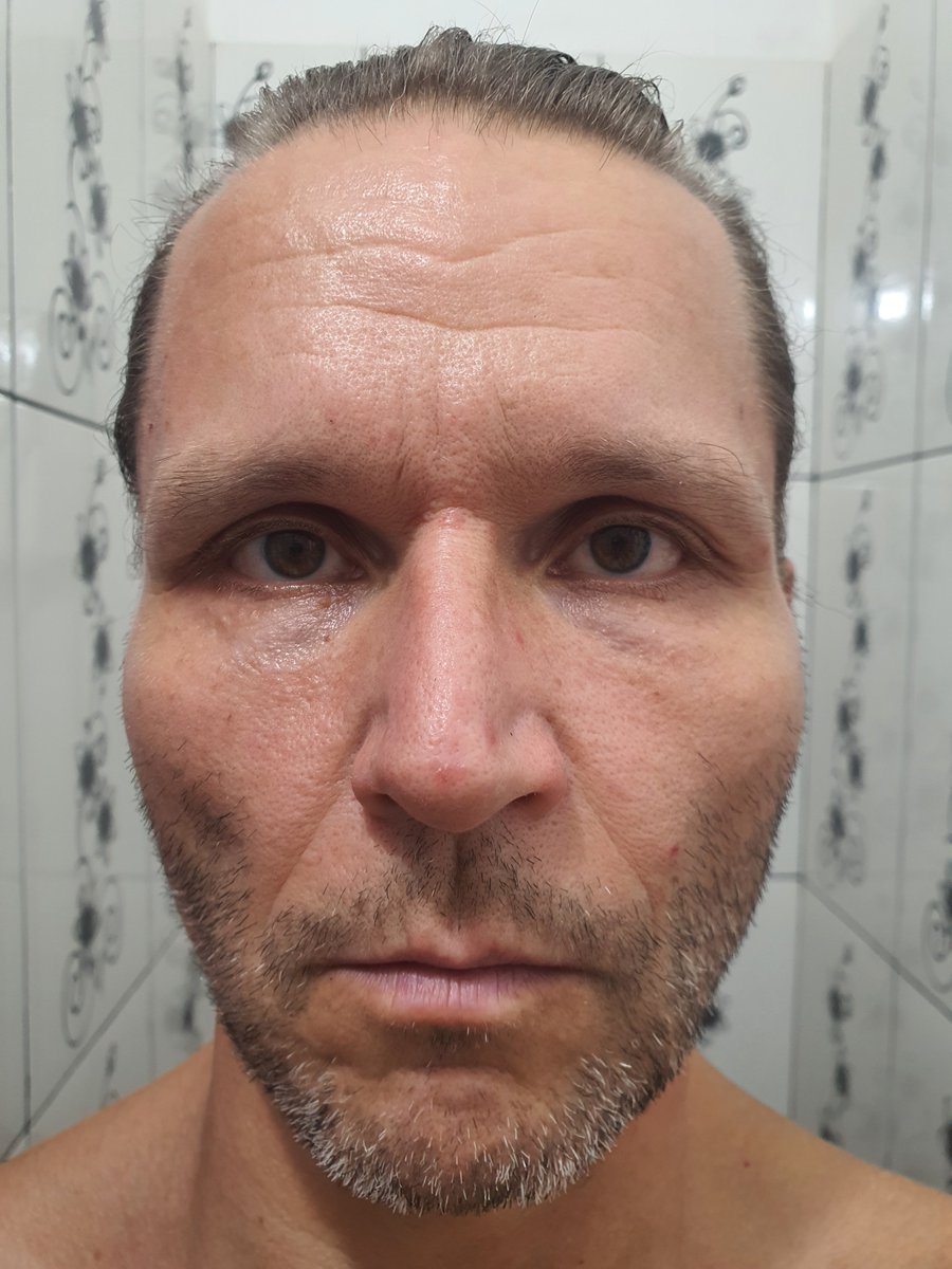 SalomonRejuven's tweet photo. ๐ฅ I found the fountain of youth of the emperors.
Day 4654 Age 54 โ reversing into low 40s.
No filters. No shortcuts. Just biology reactivated.
Goal: 25.
I post daily until I get there. Watch closely.
๐ช
#RejuvenationBodybuilding #ReverseAging #Longevity #Shredded https://t.co/YqN8BRLOkx