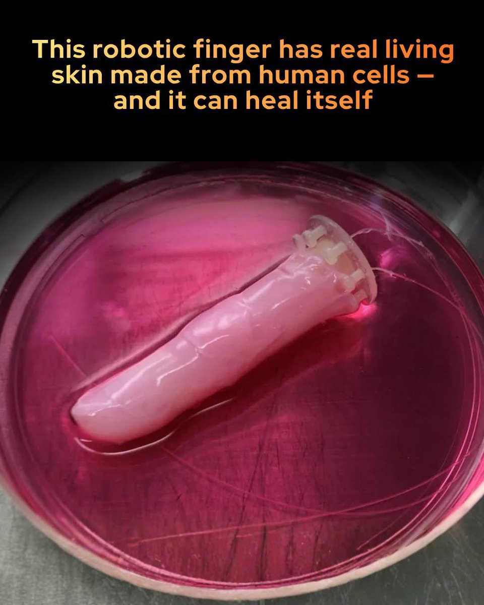 SmartScience's tweet photo. Scientists have successfully grown living human skin around a robotic finger, giving it the ability to move, bend, and even heal itself.

Researchers at the University of Tokyo have brought science fiction closer to reality by covering a working robotic finger with living skin cultured from human cells. 

Led by biohybrid engineer Shoji Takeuchi, the team submerged the robotic digit in a specialized mixture of collagen and human dermal fibroblasts, creating a supportive dermis layer. They then applied human keratinocyte cells to form a resilient outer epidermis. 

The resulting living skin is not only flexible enough to withstand continuous joint movement without tearing, but it also develops natural wrinkles at the knuckles, mimicking the look and texture of a real human hand.

Beyond its lifelike appearance, this biohybrid skin possesses a remarkable ability to self-heal. When researchers made a small incision on the finger and applied a simple collagen bandage, the skin's fibroblast cells naturally merged the bandage back into the surrounding tissue, repairing the wound within a week. 

While the technology currently requires continuous moisture to keep the living cells alive, the breakthrough opens new doors for medical testing, prosthetics, and the development of ultra-realistic humanoid robots that can interact safely and seamlessly in healthcare and service industries.

source: Kawai, M., Nie, M., Oda, H., Morimoto, Y., & Takeuchi, S. Living skin on a robot. Matter, 5(7), 2190-2208.