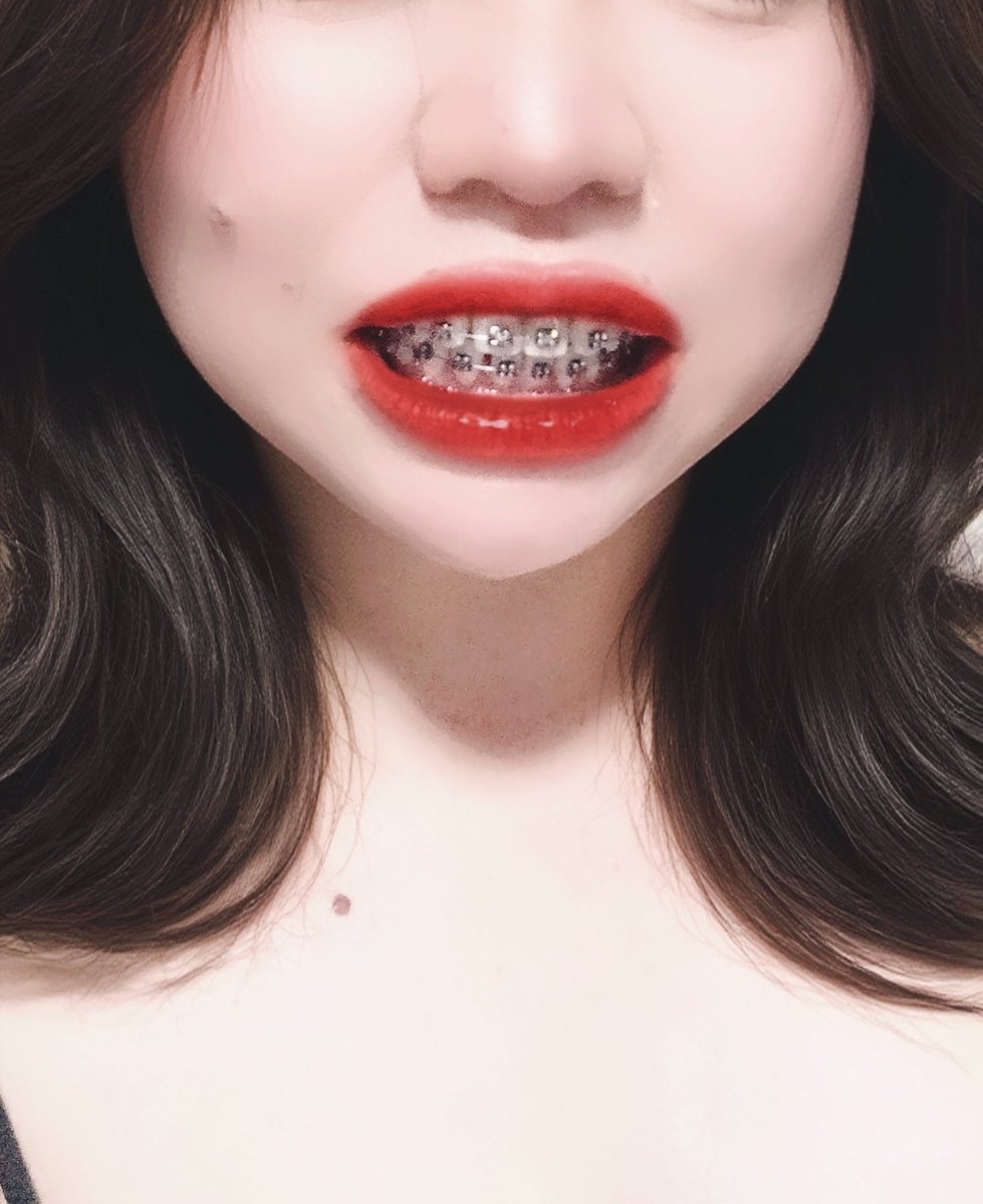 CattyyPS's tweet photo. ดัดฟันแบบนี้จะชอบมั้ยน้าา👅👅 https://t.co/FXgNERCmgW