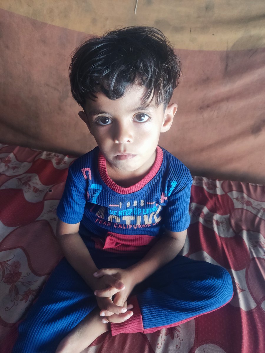 Ahmad_Salman_T's tweet photo. Thanks to you, my son Ali underwent his surgery and is recovering well; he has started eating again, and his breathing has improved.🤍

I had to borrow money to save his life, and I still owe £230.

If you can help me now, even £5 brings us closer to paying off the debt. https://t.co/oXpJHVoPNv