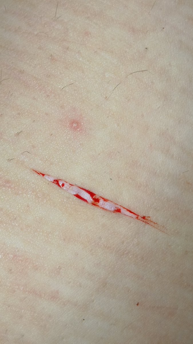 prettykittyXXD's tweet photo. i have a spot on my leg n random hairs pls ignore them all </3 

#sfx #shedrtwt https://t.co/HCeBVVhLlt