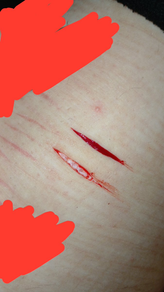 prettykittyXXD's tweet photo. i have a spot on my leg n random hairs pls ignore them all </3 

#sfx #shedrtwt https://t.co/HCeBVVhLlt