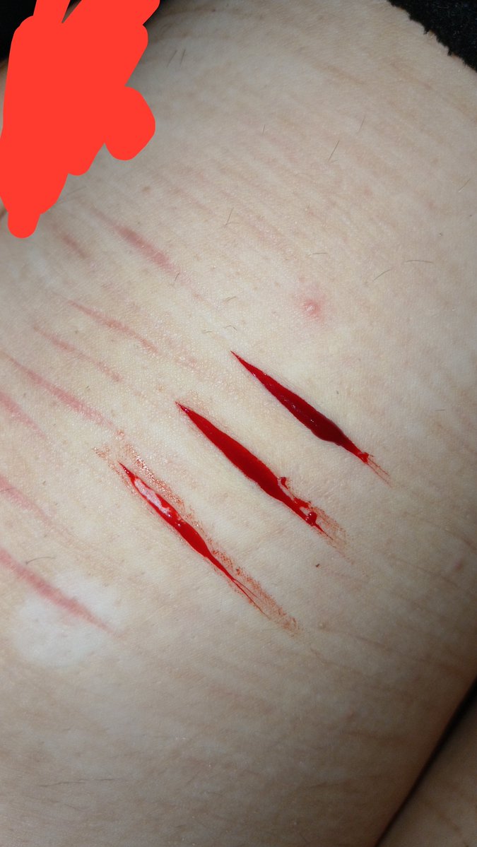 prettykittyXXD's tweet photo. i have a spot on my leg n random hairs pls ignore them all </3 

#sfx #shedrtwt https://t.co/HCeBVVhLlt
