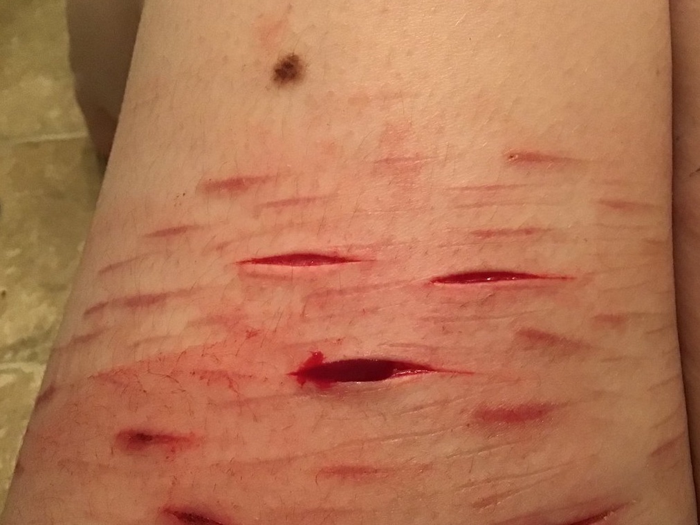 Echothe0possum's tweet photo. More makeup practice!! OwO 

(ALL SFX MAKEUP!! ONLY HALLOWEEN MAKEUP PRACTICE!! NOT REAL!) 

#SFX #slittwt #988twt #styrotwt #cutspo? #MAKEUPSFX #deepstyro #scarspo #fake #redpainttwt https://t.co/BNLtWSJHjZ