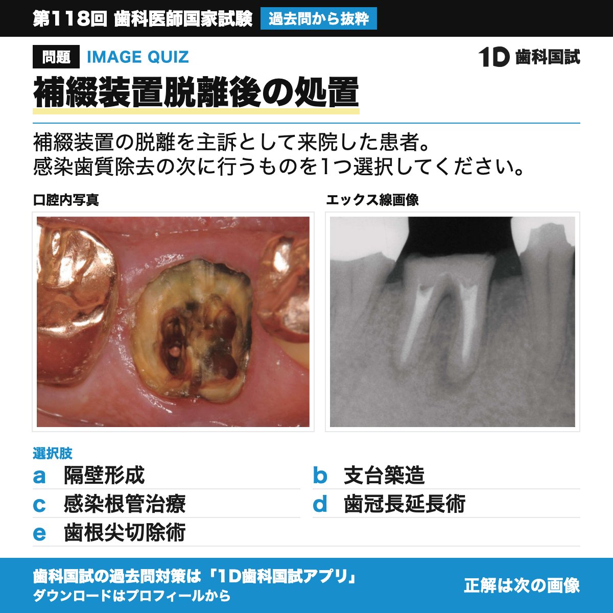 dental_study's tweet photo. https://t.co/2ACgWo8lTC