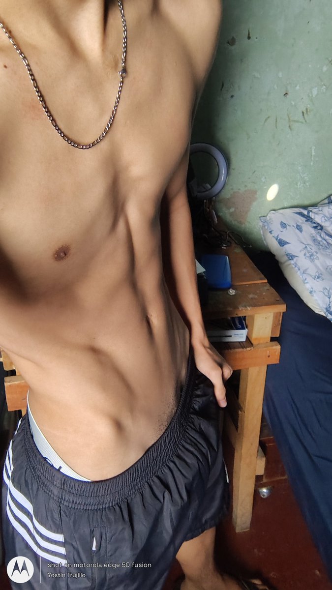 YostinTrujillo's tweet photo. Cara | cuerpo 

RT? 
#neiva #parati https://t.co/s8ZA74BCXA