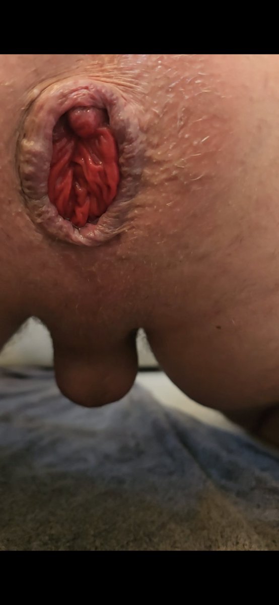 Winks_x's tweet photo. Repost if you want to make it bigger!

#Rosebud #Prolapse #Anal #Analfisting #fisting #analstretching #FF #gayff #twink #pig #fistpig #bdsm #kink #fetish https://t.co/E2LwczFFIp