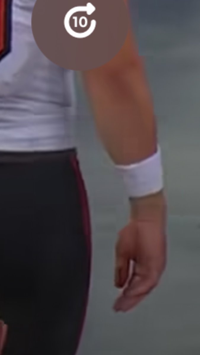 TR_DeathValley's tweet photo. @DrJesseMorse Almost positive I saw blood on that hand as he walked to the locker room so I assume it was an open dislocation.   Probably means  there’s ligament damage too? https://t.co/GKF1VeIsJj