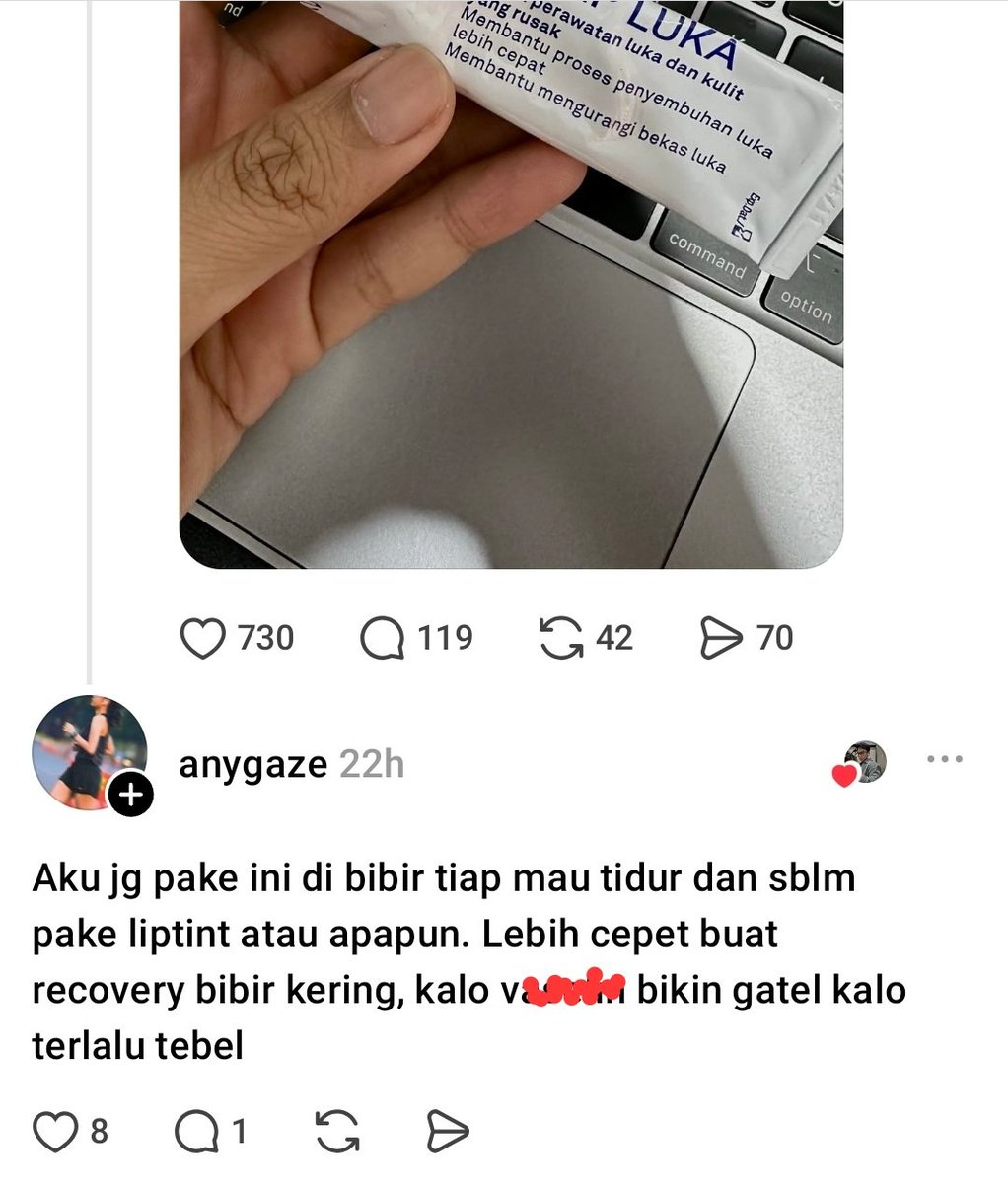 martabakismissu's tweet photo. AKHIRNYA ADA SPEAK UP 😭🙏 sayangnya masih banyak yang gatau kalo salep ini lebih mantep dibanding v*aseline repairing jelly...

Bisa dipakai buat seluruh badan juga termasuk bibir dan area selangkangan https://t.co/OHrEoB9qla