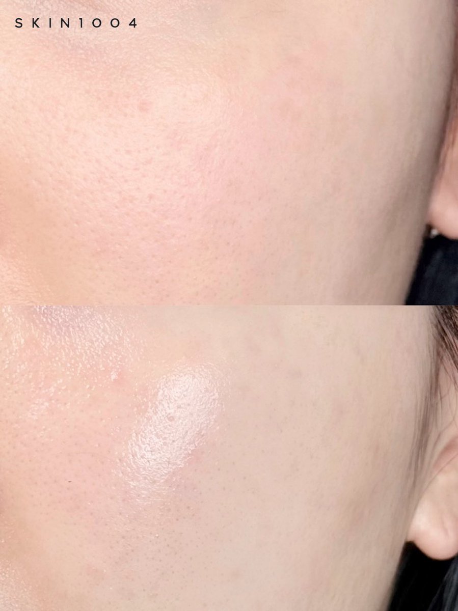 水光肌命の私が朝と夜で使い分けてるSKIN1004のスキンケアルーティン。
メイク前の0ステップとしてセンテラのパッドで肌を整えてから、
朝はパッド→アンプル→ミルクで軽やかに、夜は最後にクリームも重ねてぷるんとした水分ボリューム爆弾✨
詳しくはツリーにまとめました(PR) https://t.co/5E3ddfrVkl