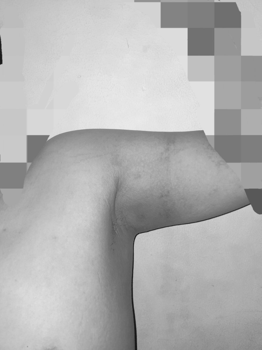 ayangkremes's tweet photo. Biceptember isi lemaknya kaka, ikutan sebelum berakhir😅 #biceptember #chubby #chaser #chubbyforchaser #bchubby #gaycikampek #gaykarawang #gaypurwakarta #gaysubang #gaycikarang #gaybekasi https://t.co/Zfjgr1mTJm