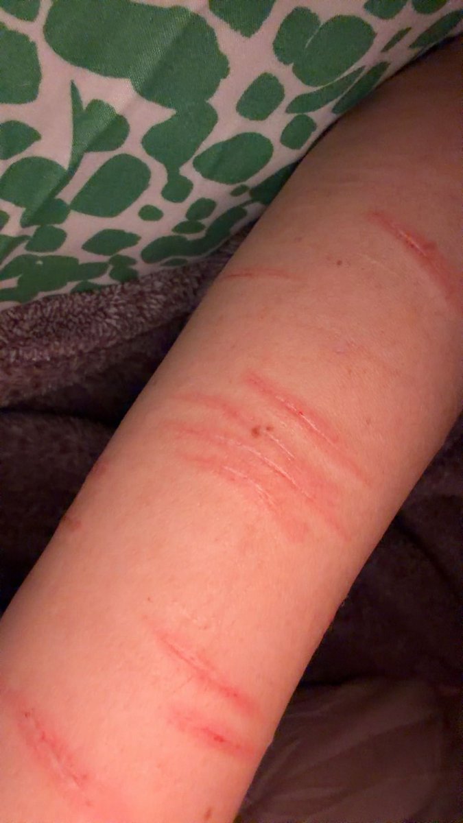 bella_plss's tweet photo. I sat in a bathroom cutting for HOURS just to forget to take photos until two days later. Amateur #shtwt #healingprocess #styro #sfx #accident https://t.co/OFXjG5ljrt
