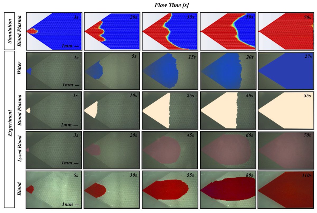 Biosensors_MDPI's tweet photo. 📣Call for Reading:
#EditorChoice #Article
Optimization of #Microfluidics for #Point-of-#Care #Blood #Sensing
By Bessire, C. et al.
https://t.co/kcFHvyv5EB
#Biosensor #OpenAccess #Biomedical #Sensors #LabOnAChip #Devices #MicroscaleFluid #Computational #Modeling #POC https://t.co/WasCDTWpug