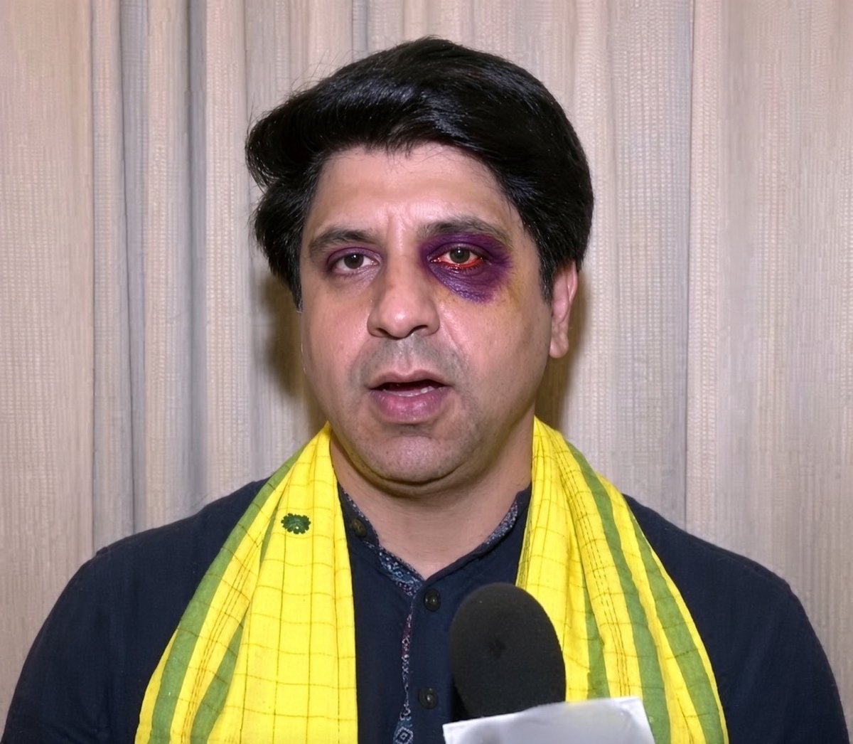 RoshanKrRaii's tweet photo. > Left Politics for a reality show
> Left his party
> Continued to lick 
> asked sanghis to support him
> went to reality show
> did congress BJP there
> got beaten up LIVE 

Tragic 😭😭😭😭😭 https://t.co/om6BqDq12N