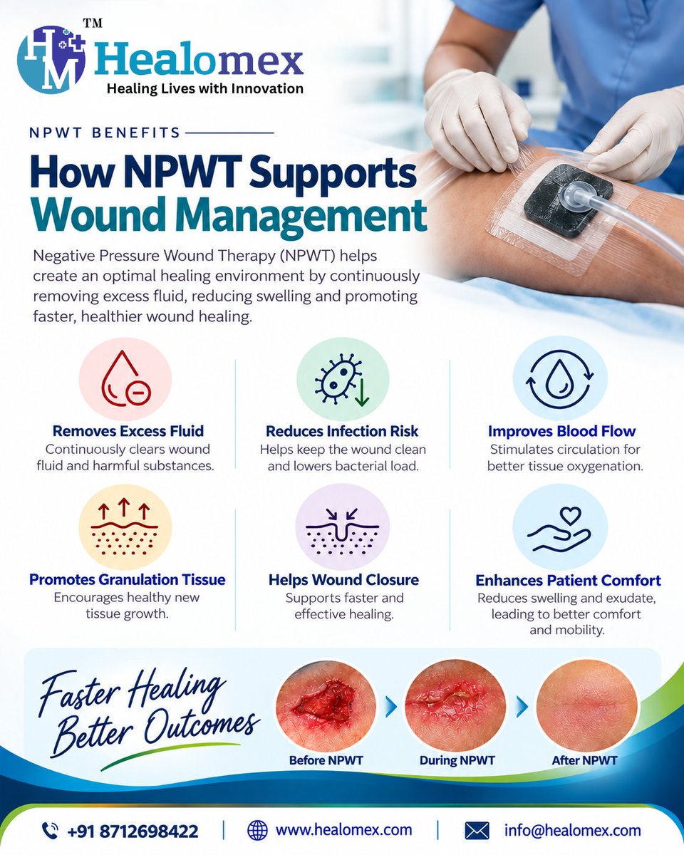 healomex's tweet photo. How NPWT Supports Wound Management | Healomex Biosciences

#Healomex #HealomexBiosciences #NPWT #NegativePressureWoundTherapy #WoundCare #WoundManagement #WoundHealing #AdvancedWoundCare #WoundCareSolutions #PatientCare #HealthcareInnovation #MedicalDevices #WoundTherapy https://t.co/FNFzPkTJuP
