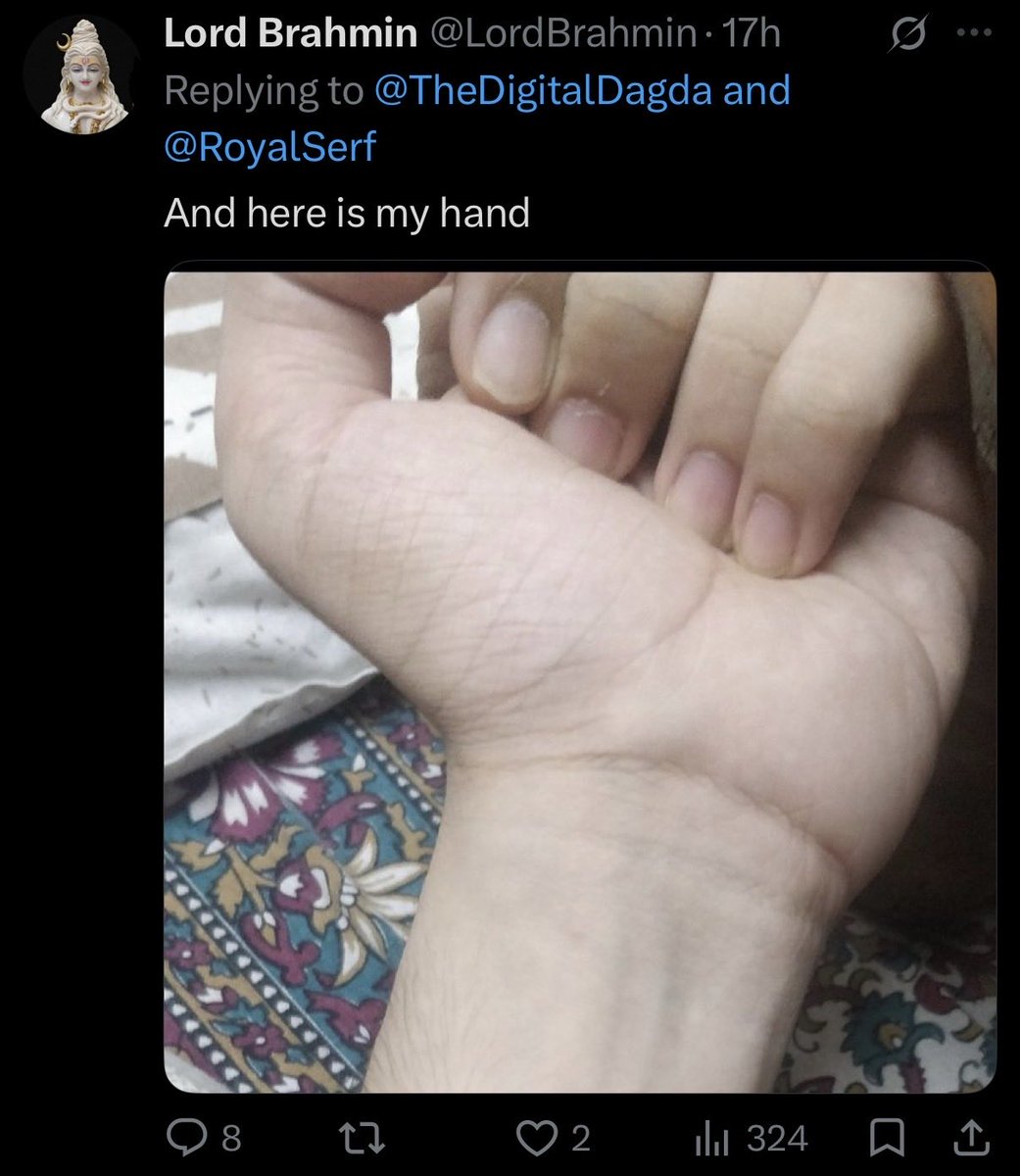Xxr2026's tweet photo. @Rampagehasarri1 @LordBrahmin @aks_jones @RoyalSerf Im not even gonna say anything, this guy is on a generational run of embarrassing himself

There’s starving Ethiopian kids with thicker forearms (and probably less brown too) https://t.co/qOh5Zdm0lp