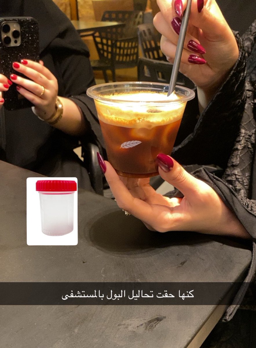 txkv9's tweet photo. اضحكو بسرعه https://t.co/yllmOF7bME