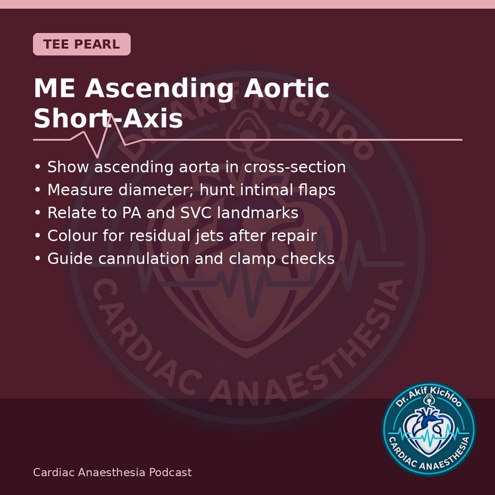 akifkichloo's tweet photo. Congenital &amp; Aorta
Norwood Stage I, Glenn physiology, arterial switch, ME ascending aorta SAX.
Cardiac Anaesthesia Podcast
#CardiacAnaesthesia #CardiacAnaesthesiaPodcast #MedEd #CardiacOR https://t.co/JCfKFXR61L