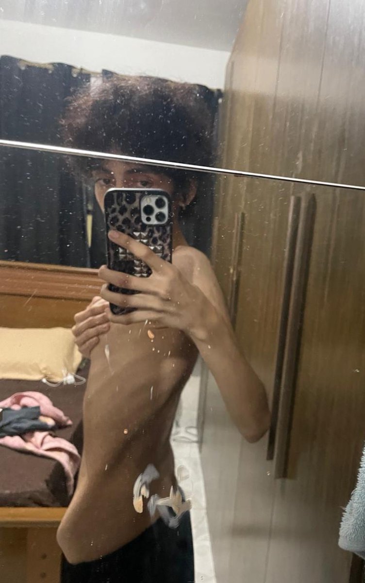 puke0kcal's tweet photo. i'm already free so whatever :p i look so fat my body is all swollen https://t.co/bBaxcCFkpe