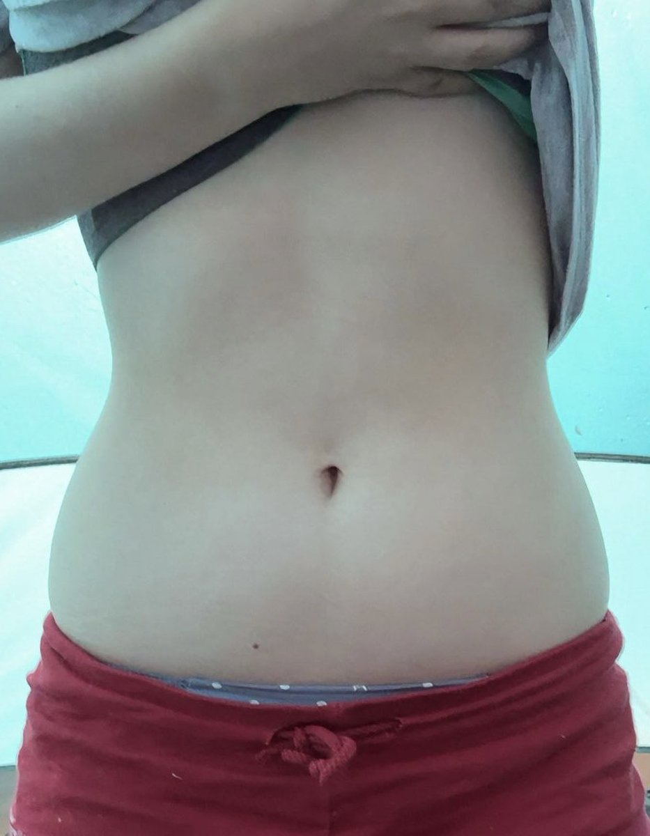 slitdani's tweet photo. sept 5th vs sept 28th
took that bodycheck while camping 😭:,) https://t.co/7U9ljJXE4m