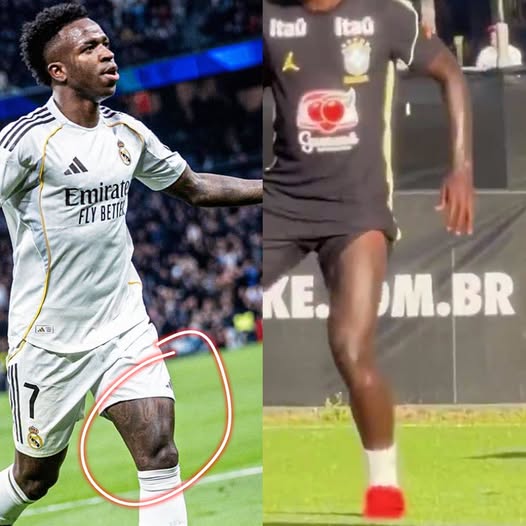 MadridSports_'s tweet photo. 🚨 Lo que me faltaba por ver: en BRASIL está cobrando fuerza una TEORÍA que afirma que VINICIUS NO ES VINICIUS

Tras su actuación ante Australia, en Brasil ha corrido como la pólvora la teoría de que VINICIUS DESAPARECIÓ y que el que está jugando es UN DOBLE para cumplir con sus contratos de PUBLICIDAD

👀 Su físico y los TATUAJES que parecen haber desaparecido de una de sus piernas, además de su nuevo rostro (la operación también sería una tapadera), serían los principales puntos que apoyan esta teoría