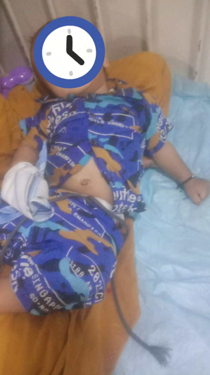 Aadiiroy2's tweet photo. یہ بچہ اس وقت شدید بیماری سے جونج رھا ھے اس کا علاج چل رھا ھے ،یہ خاندان اس وقت شدید مالی مشکلات کا شکار ھے ان کی طرف سےبچے کی خوراک اور ضروری ٹیسٹ ،ادویات کے لئے تعاون درکار ھے اگرکوئی بھائی بہن ان سے تعاون کرسکیں تو اللہ بہترین اجر عطا فرمائے گا۔جزاک اللہ خیر۔۔ https://t.co/lPVj6AoNzQ