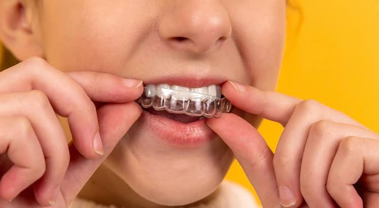 branemark1's tweet photo. El mejor tratamiento para un traumatismo dental es el que no se necesita. 🛡️🚴‍♂️ Si haces deporte de contacto, el uso de protectores bucales es innegociable. Un accidente ocurre en un segundo, pero sus consecuencias duran toda la vida. ¡A prevenir! https://t.co/WMi1NW3h44
