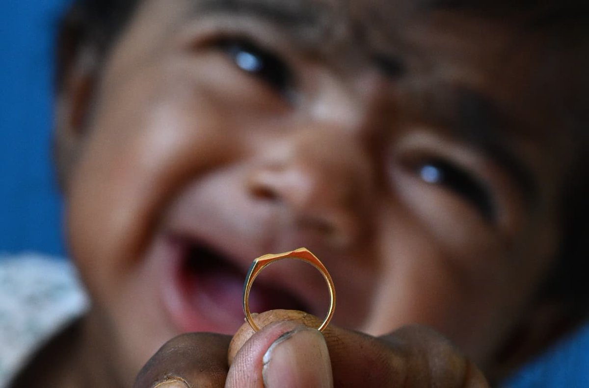 THChennai's tweet photo. After the launch of #ThaimamanThangaMothiramThittam by #TVK-led #TamilNadu government in the State, a newborn baby at #Tirunelveli Medical College Hospital received a free #gold ring under the scheme on Monday.

📸: A. Shaikmohideen (@photoshaik69) / The Hindu https://t.co/kg29uW9jGG