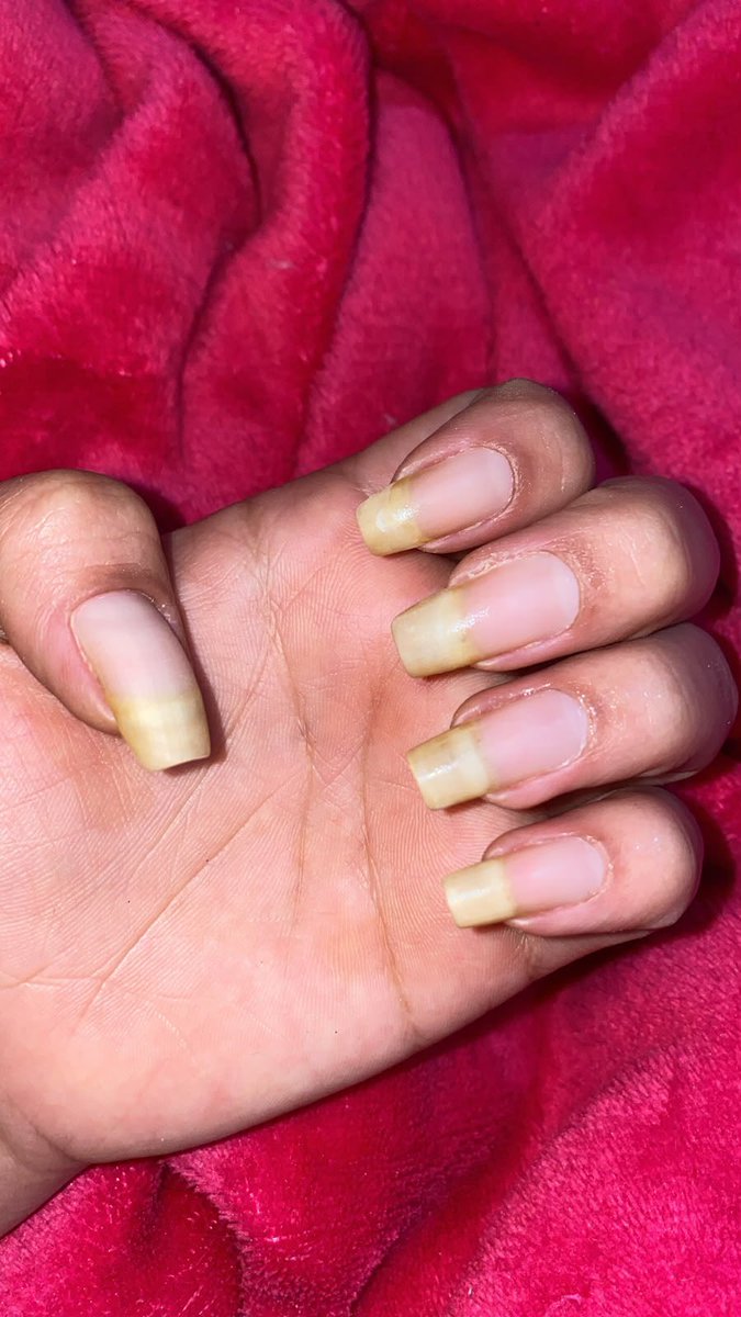 nyxzinhaa's tweet photo. Saudade de quando eu tinha paciência pra deixar elas crescerem 🫠 https://t.co/BgVZ78NkVA