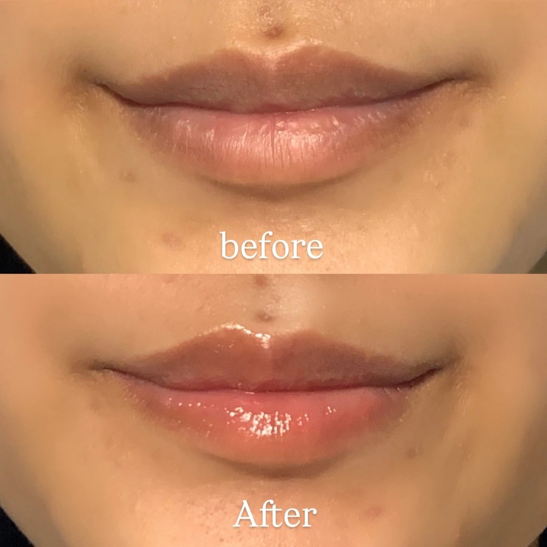 moonlightshasaa's tweet photo. Siapa nih yang punya bibir kering apalagi sampe nge kopekin bibirnya‼️

Makasih banget buat yang udah racunin aku lip care ini karena berhasil bikin bibir aku keliatan lembab seharian 😖🫶🏻 https://t.co/hcAn4WxLnO