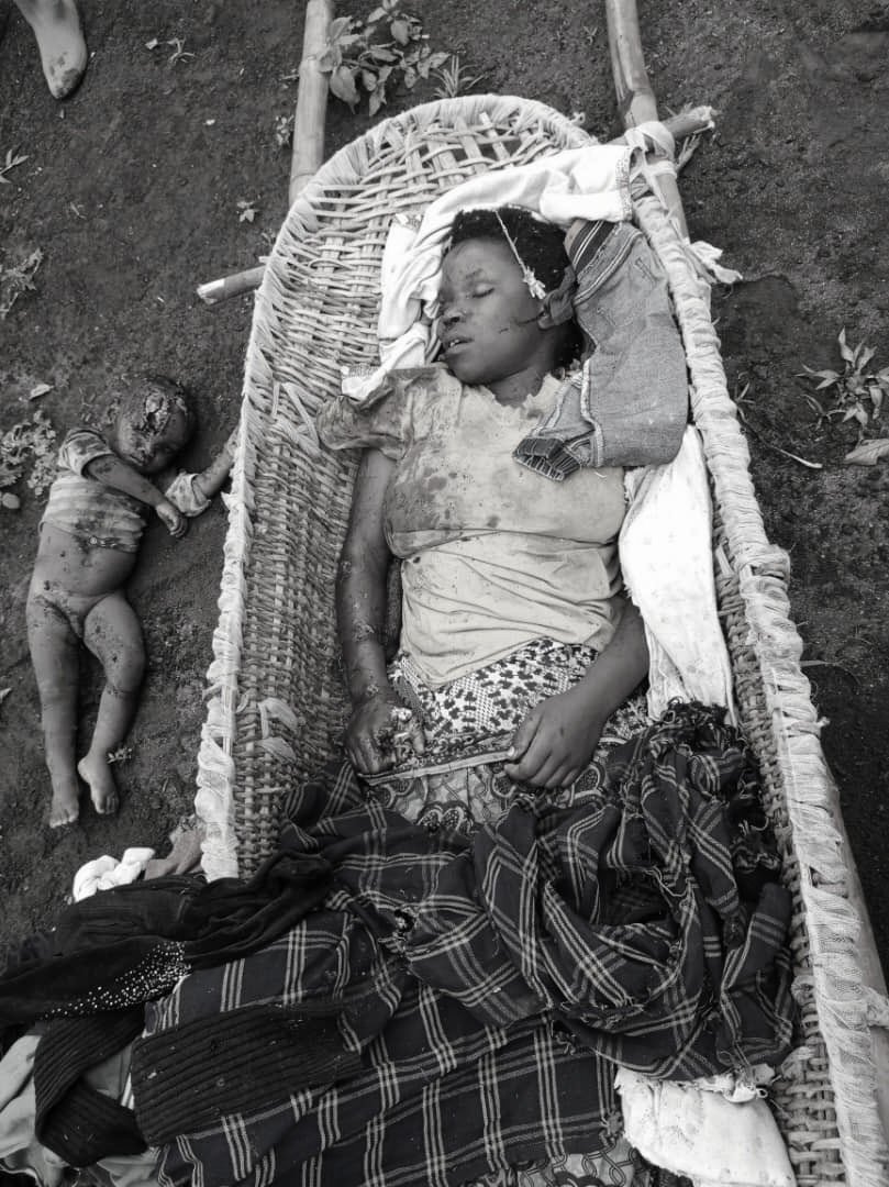 FaithNtako65514's tweet photo. 🚨🇨🇩 #BITOYI : DES CIVILS TUÉS APRÈS DE NOUVEAUX BOMBARDEMENTS DE L'ARMÉE RWANDAISE M23-RDF.
De nouveaux bombardements attribués à l’armée rwandaise M23-RDF ont été signalés ce lundi à #Bitoyi, dans le territoire de #Masisi, après une première alerte rapportée dans la matinée.
Selon des informations recueillies localement, plusieurs civils ont été tués, parmi lesquels des femmes et des enfants. Le bilan provisoire reste encore à vérifier et pourrait évoluer.
La situation demeure critique sur place.